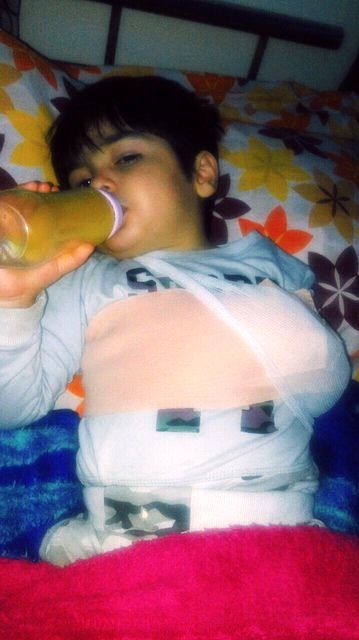 شکستن استخوان ترقوه‌ پسر 3 ساله در مهدکودک/ تایید حادثه کودک‌آزاری